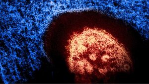 Measles virus close-up